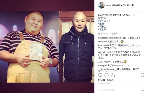 安田大サーカス hiro ダイエット 入院 脳外科 卒業