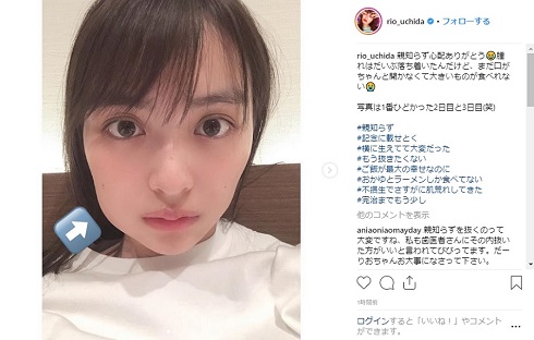 内田理央 親知らず Instagram