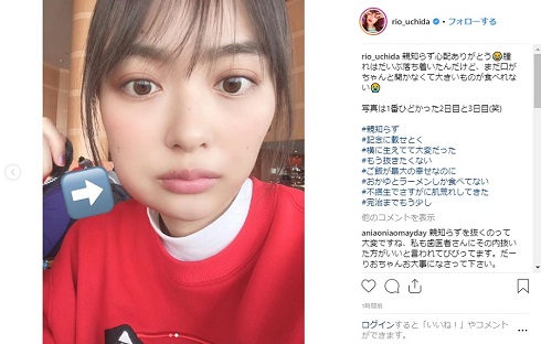 内田理央 親知らず