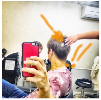 GACKT YOSHIKI 芸能人格付けチェック 円形脱毛症