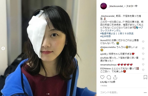 松井玲奈 ブラックスキャンダル 唯菜 山口紗弥加 大ケガ 包帯 亜梨沙