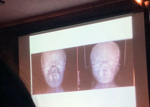 美容整形トークイベント