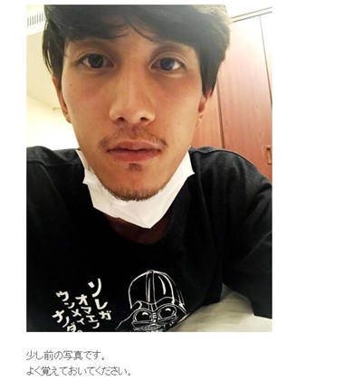 Nosuke misono 癌 ガン ボウズ 副作用