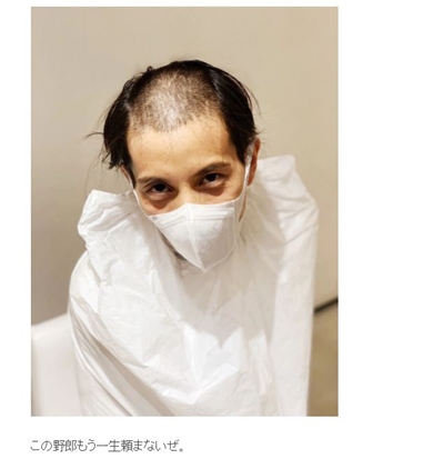 Nosuke misono 癌 ガン 坊主頭