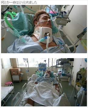 滝川英治 脊髄損傷 復帰 弱虫ペダル 弱ペダ 実写ドラマ 事故 自転車