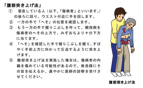 正月 餅 窒息 高齢者 事故 注意喚起 応急手当