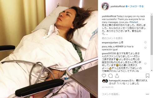 YOSHIKI スケートボード 動画 危ない ヒヤヒヤ コケる スケボ