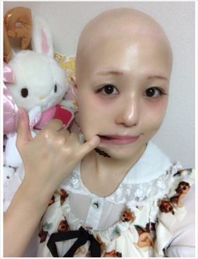 pippi 全身脱毛症 エレクトリックリボン アイドル 治療