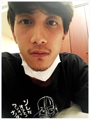 Nosuke 退院 精巣がん 胚細胞腫瘍 手術 抗がん剤 HighsidE misono 髪