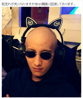 Nosuke ISSA USA ドラムカバー DAPUMP 精巣がん 入院 手術