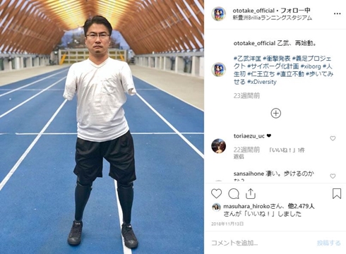 乙武洋匡 母 赤ちゃん 幼少期 写真 先天性四肢切断