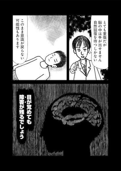 交通事故で頭を強打したらどうなるか？