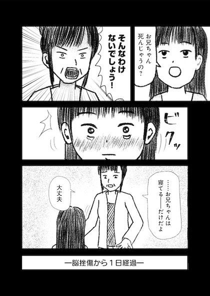 交通事故で頭を強打したらどうなるか？