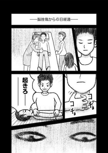 交通事故で頭を強打したらどうなるか？