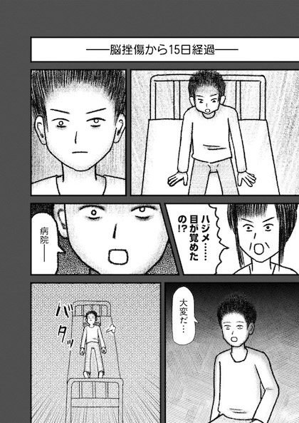 交通事故で頭を強打したらどうなるか？