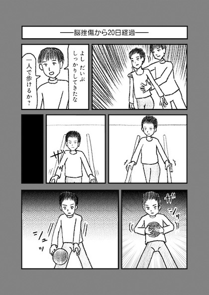 交通事故で頭を強打したらどうなるか？