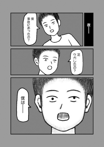 交通事故で頭を強打したらどうなるか？