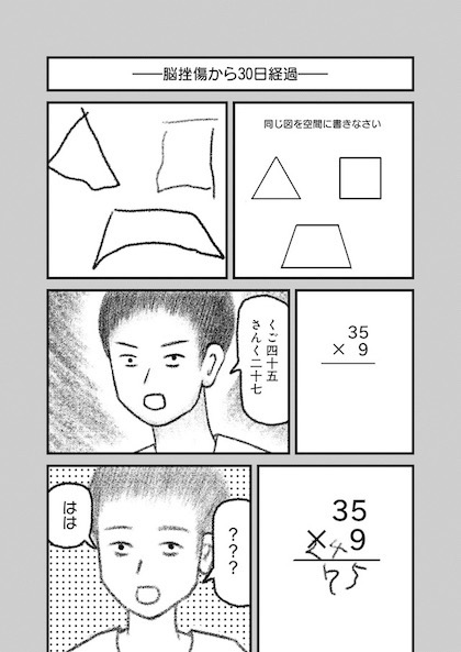 交通事故で頭を強打したらどうなるか？