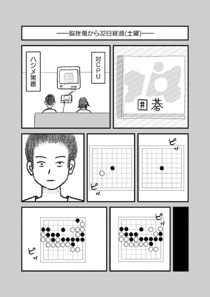 交通事故で頭を強打したらどうなるか？