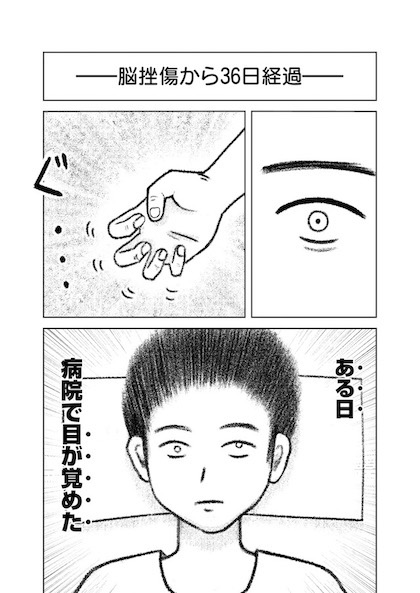 交通事故で頭を強打したらどうなるか？