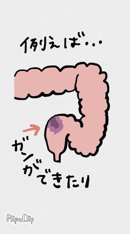 オストメイト式トイレ