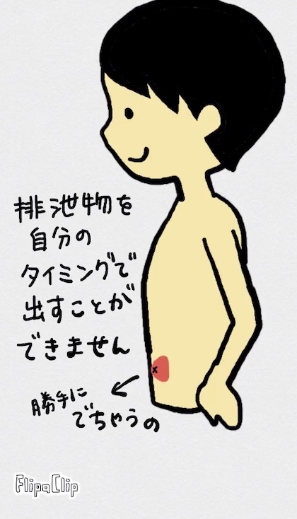オストメイト式トイレ