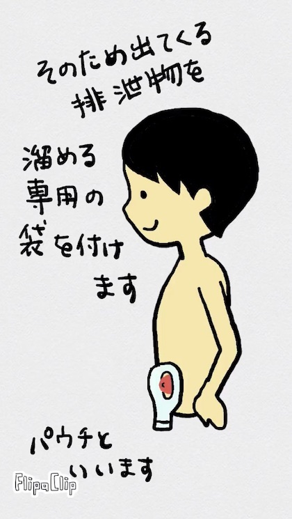オストメイト式トイレ