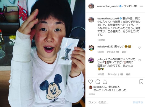 鈴木おさむ 大島美幸 骨折 プレート いつ 息子 エフ