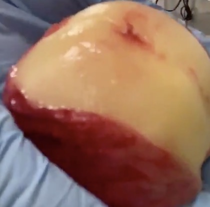 桃の皮をつるんと剥く方法