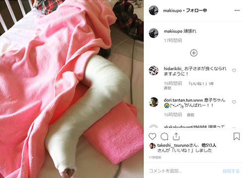 マキタスポーツ オフィス北野 家族 手術 双子 Instagram