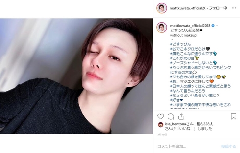 Matt マット 紅蘭 メイク 整形 物珍しい 自覚