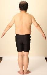 森永卓郎 RIZAP ライザップ リバウンド 糖尿病 ビフォーアフター