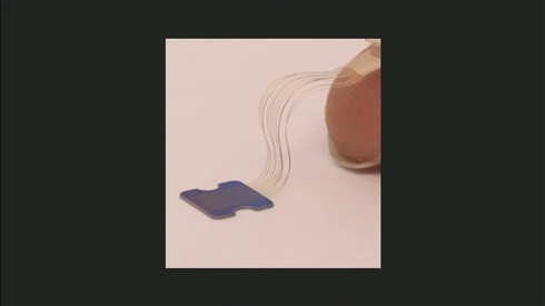 イーロン・マスクの「ニューラリンク」、脳埋め込みインタフェースを実用化へ　2020年に臨床試験