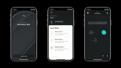 イーロン・マスクの「ニューラリンク」、脳埋め込みインタフェースを実用化へ　2020年に臨床試験