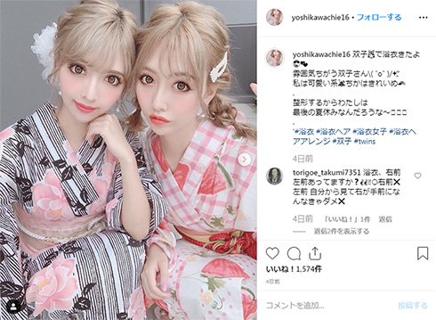 吉川ちえ 整形 鼻 鼻骨骨削り 鼻中隔延長 ダウンタイム