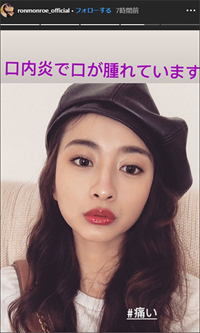 ロン・モンロウ 栗子 ガッキー 新垣結衣 中国 セクシー