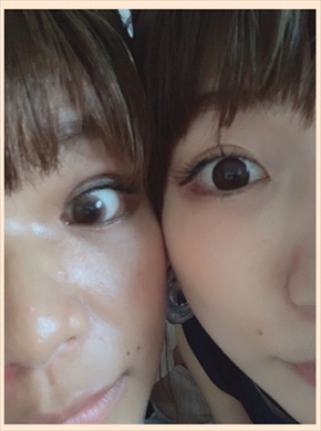 クロ 桃 整形 あいのり 二重 埋没 手術 プチ整形 ブログ