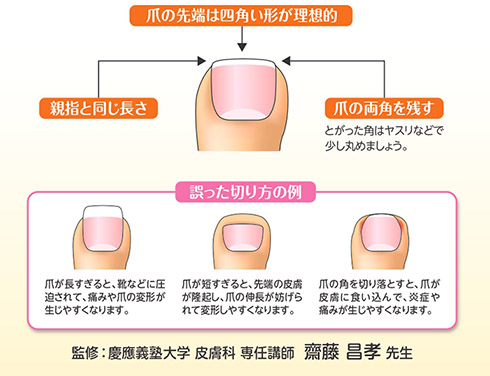 爪切り 爪 トラブル 皮膚科 皮膚