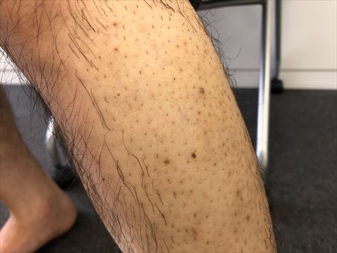 moomo ヘルスアップ 自然派研究所 アフィリエイト