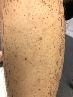 moomo ヘルスアップ 自然派研究所 アフィリエイト