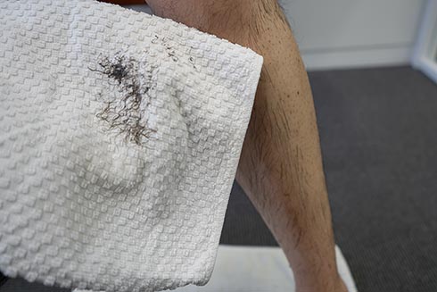 moomo ヘルスアップ 自然派研究所 アフィリエイト