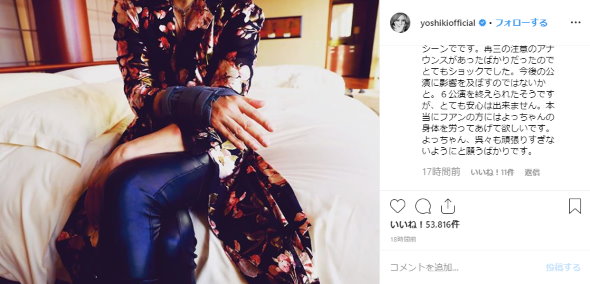 めちゃ痛そう……YOSHIKIが負傷した右腕の状態を公開 「アーティストの手に触れる時は優しくね」呼びかけ | ねとらぼ