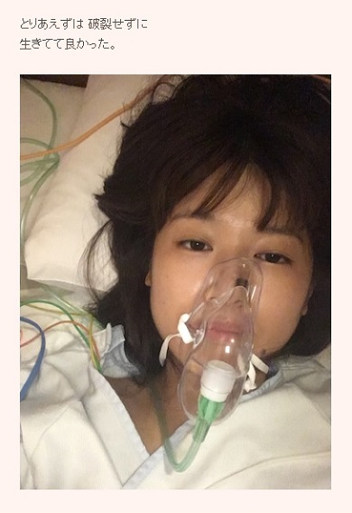 小林礼奈 流れ星 瀧上伸一郎 子宮外妊娠 手術