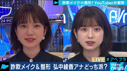 弘中綾香 弘中アナ 詐欺メイク 整形