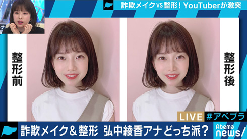 弘中綾香 弘中アナ 詐欺メイク 整形