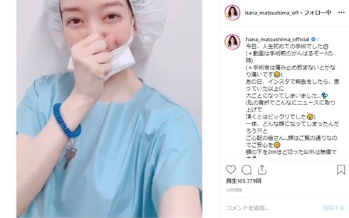 松島花 アゴ 骨折 手術 モデル