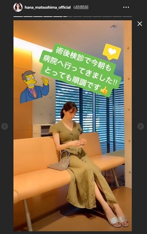 松島花 アゴ 骨折 手術 モデル