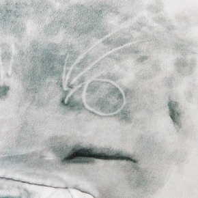 ユキちゃんとアラレちゃん