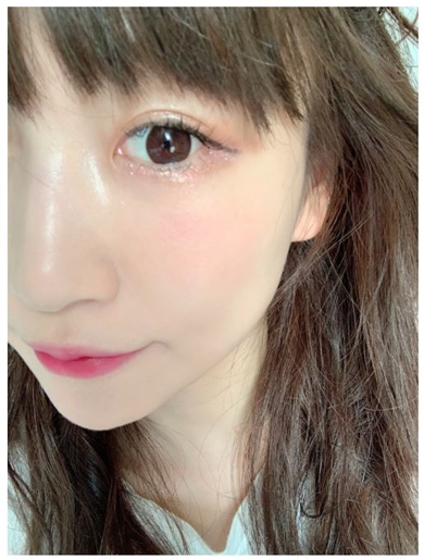 あいのり桃 整形 埋没法 再整形 二重