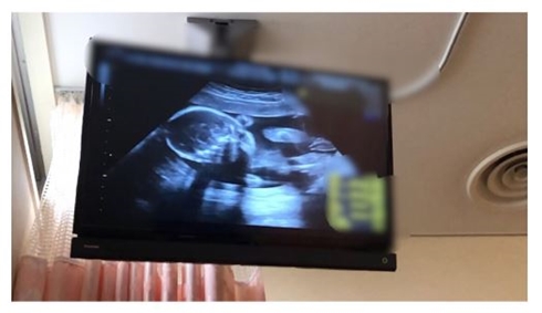 藤本美貴 庄司智春 妊娠 第3子 エコー写真